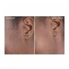 3-csomag Bondiblades női Derma Razor Dermaplaning Razor for Removing barack haj, rózsaszín Méret: N